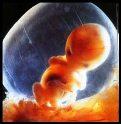 8 weeks pregnant