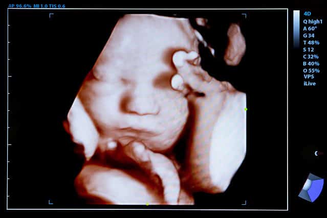 baby in the womb 3D ultrasound