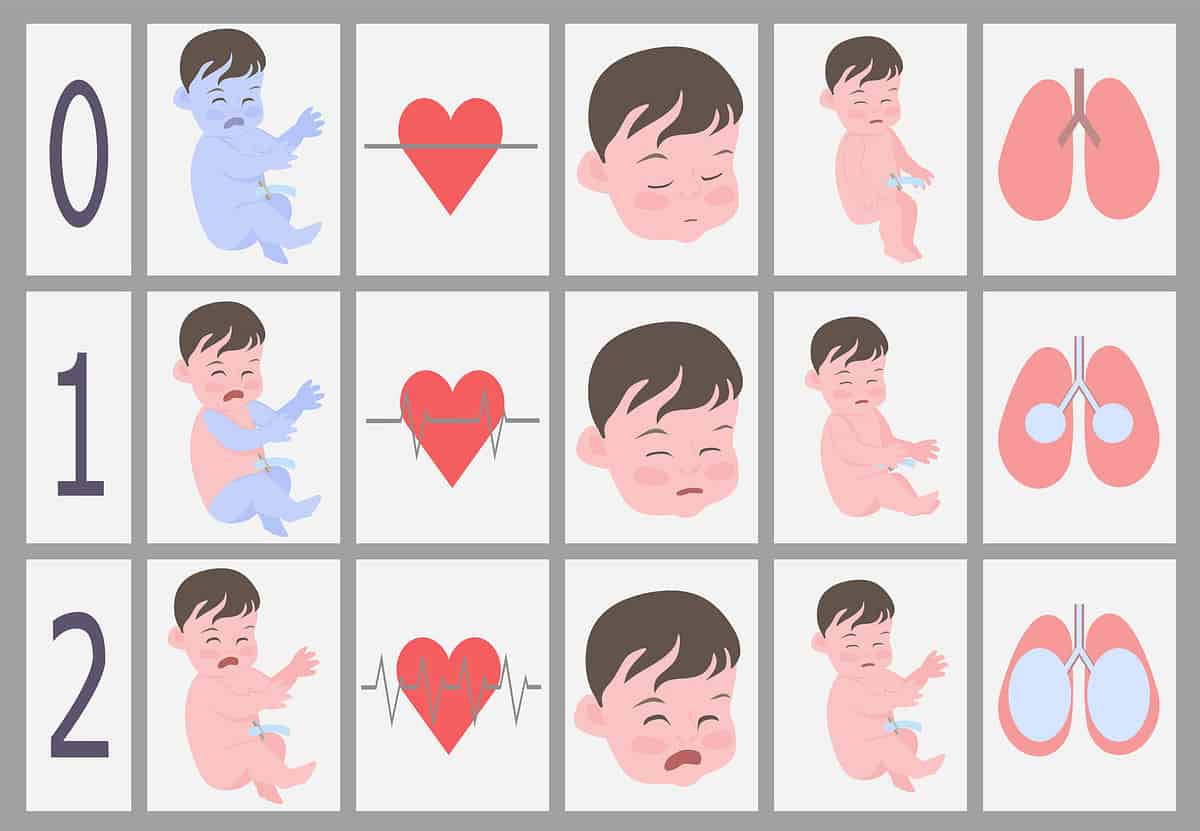 Apgar chart to assess newborn baby