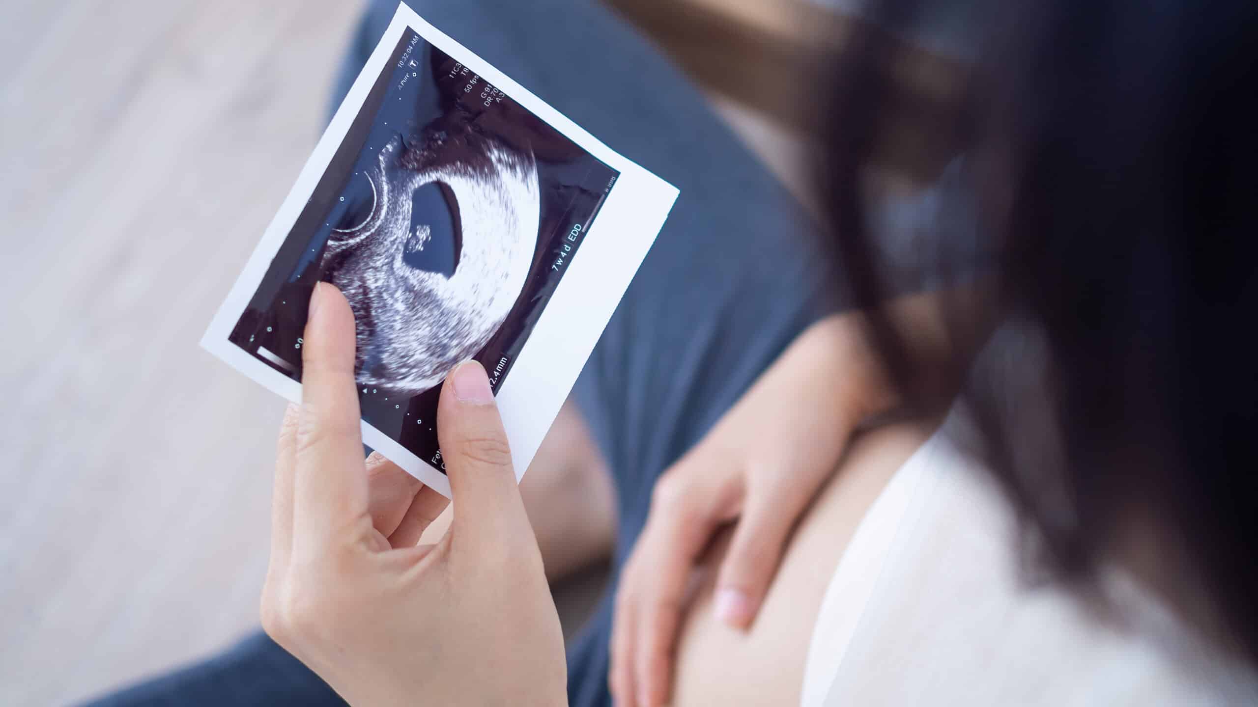 Pregnancy in Your 40s: What to Expect From a "Geriatric Pregnancy"