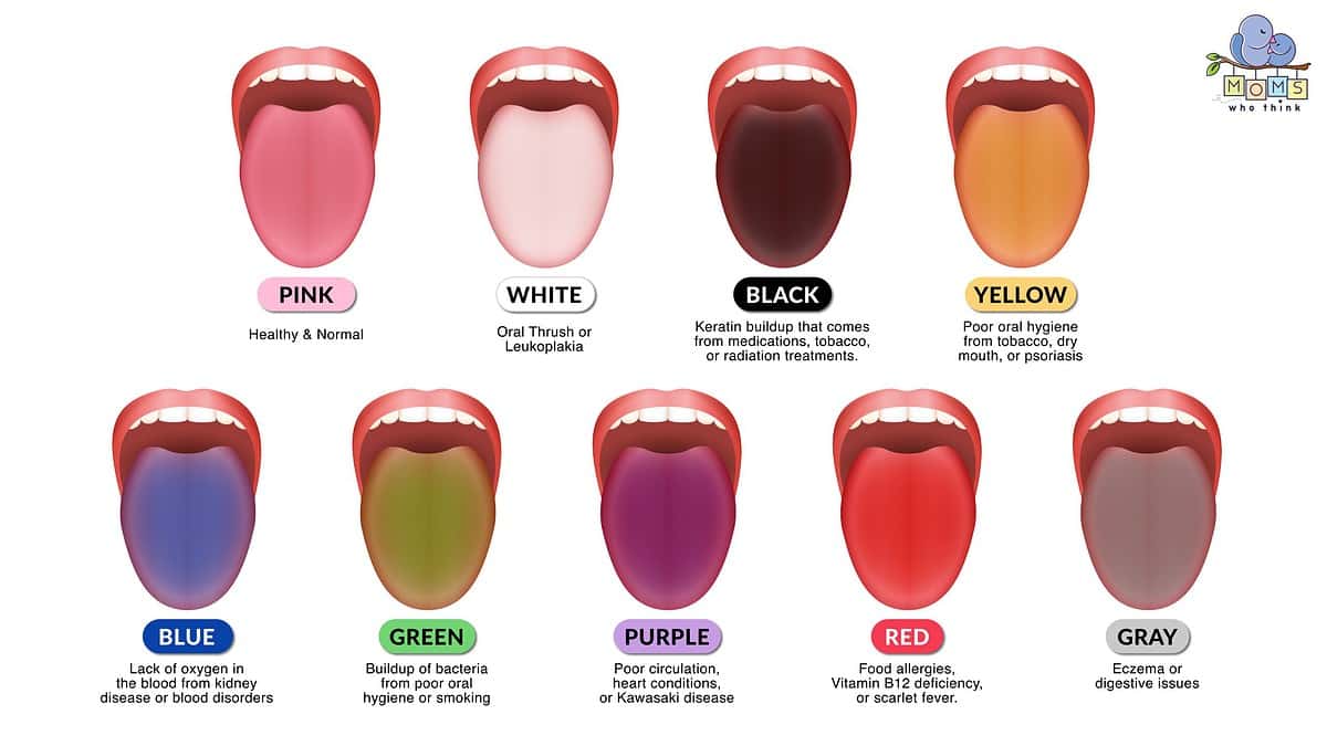 Tongue color chart