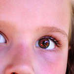 Eye Conditions