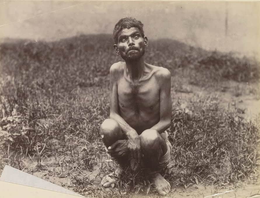 This Boy Raised by Gazelles Could Run as Fast as Cars